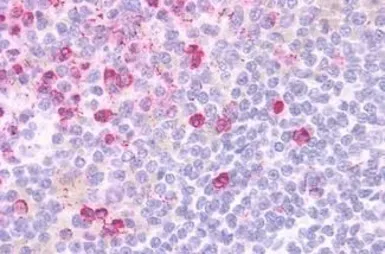 Anti-GPCR HM74 antibody used in IHC (Paraffin sections) (IHC-P). GTX12610