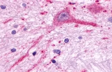 Anti-MCHR2 antibody used in IHC (Paraffin sections) (IHC-P). GTX12674