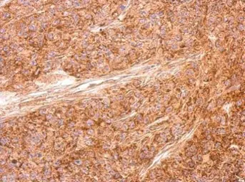 Anti-AICDA antibody used in IHC (Paraffin sections) (IHC-P). GTX127276