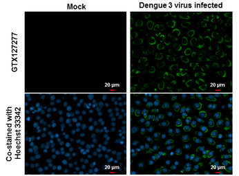 Anti-Dengue virus Envelope protein antibody used in Immunocytochemistry/ Immunofluorescence (ICC/IF). GTX127277