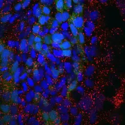Anti-Rab11a + Rab11b antibody used in Immunohistochemistry (IHC). GTX127328