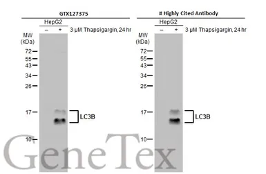 Anti-LC3B antibody used in Western Blot (WB). GTX127375