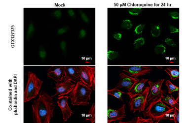 Anti-LC3B antibody used in Immunocytochemistry/ Immunofluorescence (ICC/IF). GTX127375