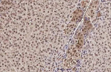 Anti-HYPB/SETD2 antibody used in IHC (Paraffin sections) (IHC-P). GTX127905