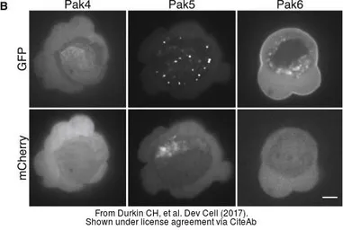 Anti-PAK6 antibody used in Immunocytochemistry/ Immunofluorescence (ICC/IF). GTX127915
