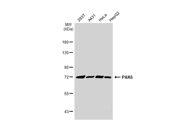 Anti-PAK6 antibody used in Western Blot (WB). GTX127915