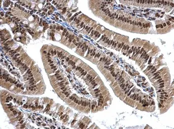 Anti-hnRNP A2B1 antibody used in IHC (Paraffin sections) (IHC-P). GTX127928