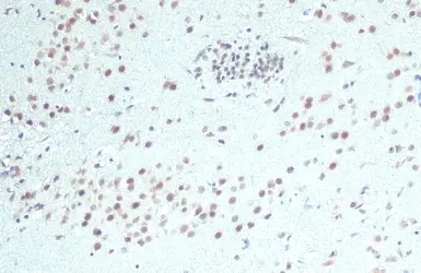 Anti-hnRNP A2B1 antibody used in IHC (Paraffin sections) (IHC-P). GTX127928
