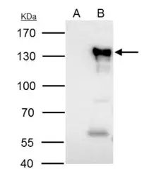 Anti-NFAT1 antibody used in Immunoprecipitation (IP). GTX127932