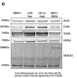 Anti-Grp78 antibody used in Western Blot (WB). GTX127934
