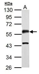Anti-CaMKII alpha antibody used in Western Blot (WB). GTX127939