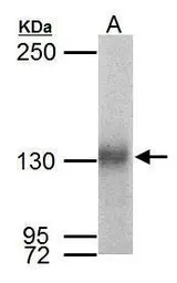 Anti-Neuropilin 1 antibody used in Western Blot (WB). GTX127947