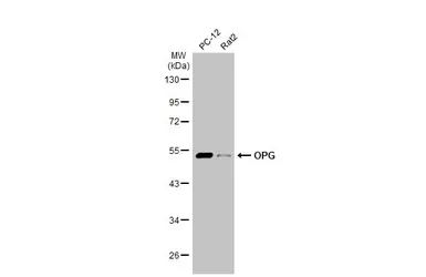 Anti-OPG antibody used in Western Blot (WB). GTX127948