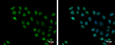 Anti-HMGB1 + HMGB2 antibody used in Immunocytochemistry/ Immunofluorescence (ICC/IF). GTX127972