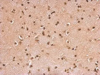 Anti-HMGB1 + HMGB2 antibody used in IHC (Paraffin sections) (IHC-P). GTX127972