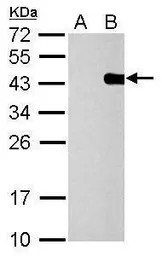 Anti-PITX2 antibody used in Western Blot (WB). GTX127973