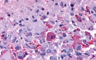 Anti-TM7SF1/GPR137B antibody used in IHC (Paraffin sections) (IHC-P). GTX12800