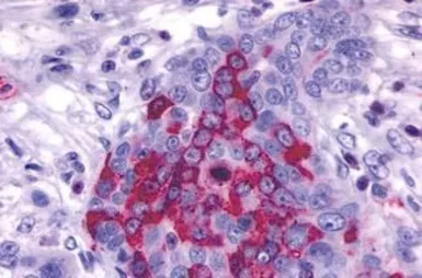 Anti-TM7SF1/GPR137B antibody used in IHC (Paraffin sections) (IHC-P). GTX12800