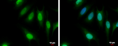 Anti-CFDP1 antibody used in Immunocytochemistry/ Immunofluorescence (ICC/IF). GTX128025