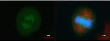 Anti-CEP152 antibody used in Immunocytochemistry/ Immunofluorescence (ICC/IF). GTX128027