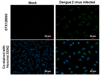Anti-Dengue virus prM protein antibody used in Immunocytochemistry/ Immunofluorescence (ICC/IF). GTX128093