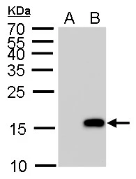 Anti-Histone H3S10ph (phospho Ser10) antibody used in Western Blot (WB). GTX128116