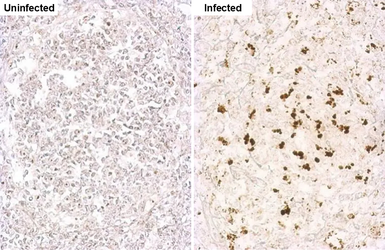 Anti-Porcine circovirus type 2 / PCV2 Capsid antibody used in IHC (Paraffin sections) (IHC-P). GTX128120