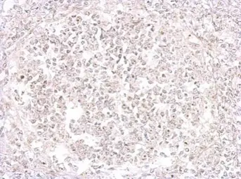 Anti-Porcine circovirus type 2 / PCV2 Capsid antibody used in IHC (Paraffin sections) (IHC-P). GTX128120
