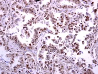 Anti-ATR antibody used in IHC (Paraffin sections) (IHC-P). GTX128146