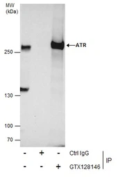 Anti-ATR antibody used in Immunoprecipitation (IP). GTX128146