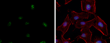 Anti-ATR antibody used in Immunocytochemistry/ Immunofluorescence (ICC/IF). GTX128146