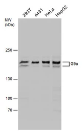 Anti-G9a antibody used in Western Blot (WB). GTX128164