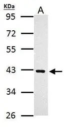 Anti-PRMT1 antibody used in Western Blot (WB). GTX128211