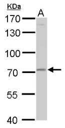 Anti-MMP24 antibody used in Western Blot (WB). GTX128246