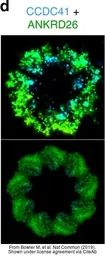 Anti-ANKRD26 antibody used in Immunocytochemistry/ Immunofluorescence (ICC/IF). GTX128255
