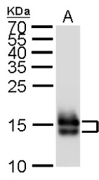 Anti-Myl7 antibody used in Western Blot (WB). GTX128346