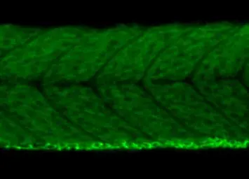 Anti-Vegfaa antibody used in IHC (Whole mount) (IHC-Wm). GTX128356