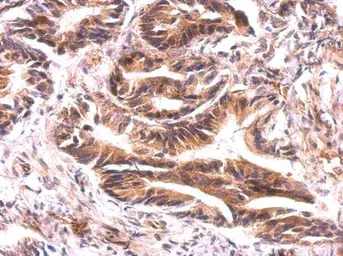 Anti-ATG9A antibody used in IHC (Paraffin sections) (IHC-P). GTX128427