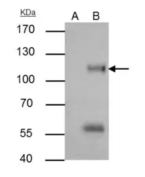 Anti-ATG9A antibody used in Immunoprecipitation (IP). GTX128427