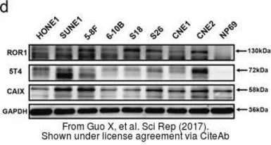 Anti-Carbonic Anhydrase IX antibody used in Western Blot (WB). GTX128428