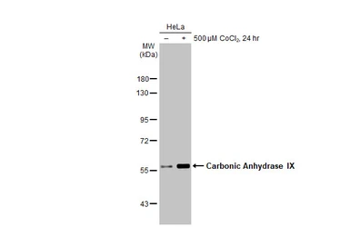 Anti-Carbonic Anhydrase IX antibody used in Western Blot (WB). GTX128428