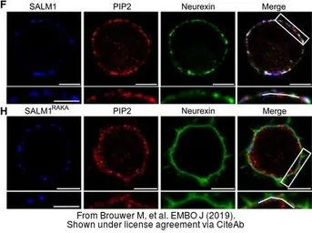 Anti-mCherry antibody used in Immunocytochemistry/ Immunofluorescence (ICC/IF). GTX128508