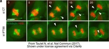 Anti-mCherry antibody used in Immunocytochemistry/ Immunofluorescence (ICC/IF). GTX128508