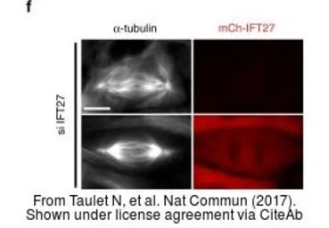 Anti-mCherry antibody used in Immunocytochemistry/ Immunofluorescence (ICC/IF). GTX128508