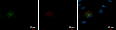 Anti-mCherry antibody used in Immunocytochemistry/ Immunofluorescence (ICC/IF). GTX128508