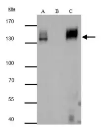 Anti-mCherry antibody used in Immunoprecipitation (IP). GTX128508