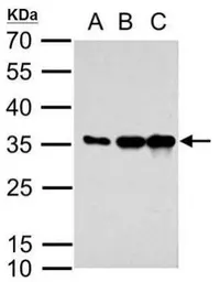 Anti-mCherry antibody used in Western Blot (WB). GTX128508