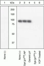 Anti-Syk (phospho Tyr323) antibody used in Western Blot (WB). GTX12862
