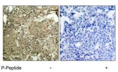 Anti-Cofilin 1 (phospho Ser3) antibody used in IHC (Paraffin sections) (IHC-P). GTX12866
