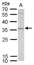Anti-SLUG antibody used in Western Blot (WB). GTX128796